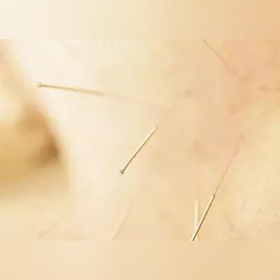 最新脑瘫治疗进展,创新疗法引领康复新希望