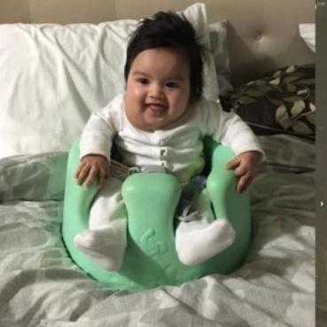 淋巴管畸形治疗最新进展研究