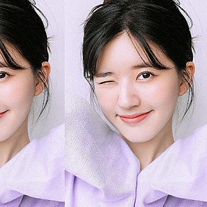 国际最新脱发治疗技术,重塑秀发魅力