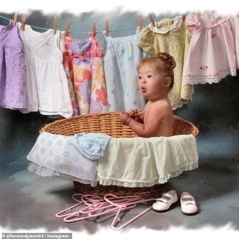 唐氏综合症患者的现状与挑战，最新贴吧热议话题