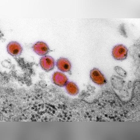 最新病毒威胁全球安全，XXXX年数据报告分析